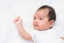 Trẻ Bị Sôi Bụng 